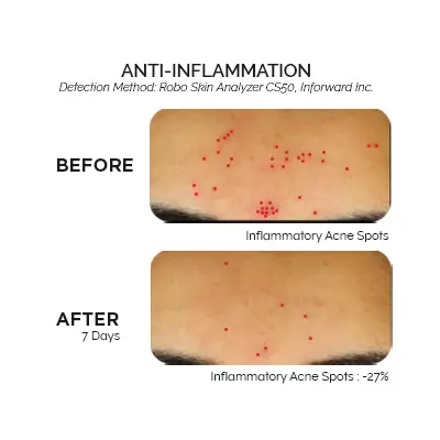 Exoderm anti-inflammation results visual 1