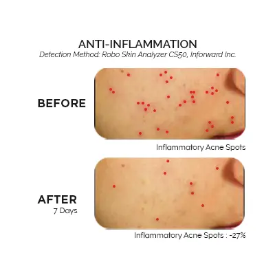 Exoderm anti-inflammation results visual 2